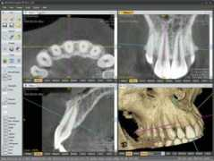 irc.joher.com Dicom