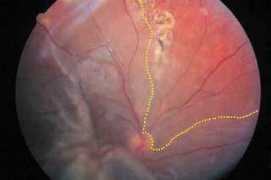 oculistica-tricase.it Distac