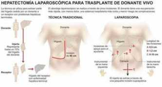 laverdad.es Donante