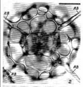 radiolaria.org Dumitrica