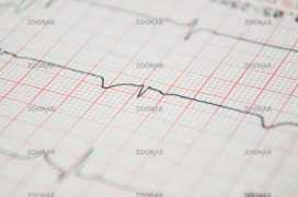 zoonar.com Ekg