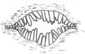 Engedahl