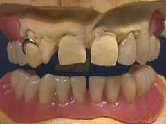infodental.it Estenia