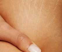 alienado.net Estrias