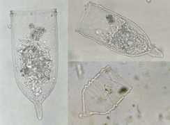 protist.i.hosei.ac.jp Favella