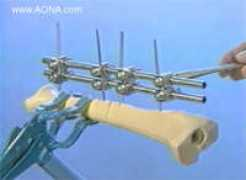 tristan.membrane.com Fixr