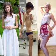 notitarde.com Flacura