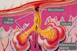 Follicle