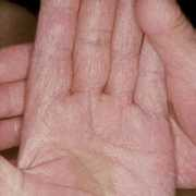 fungalguide.ca Fungal