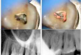 dentalindia.com Furar