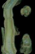 cnph.embrapa.br Fusario