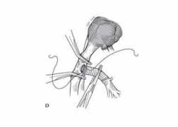 illustrationsmedical.com Huberd