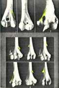 anatomyatlases.org Humeri