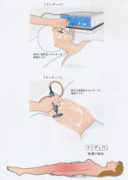 yoshiiclinic.jp Indiba