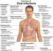 Infections