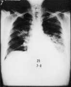 bioweb.uwlax.edu Ionella