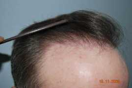 thaihairclinic.com Jozs