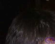 Kasopa