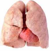 israblog.nana10.co.il Klodet