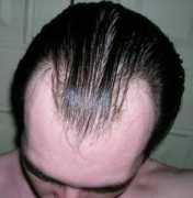 howtogrowhairfasternaturally.net Kolondam