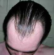 howtogrowhairfasternaturally.net Kolondam