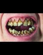 vampireteeth.com Kreeper