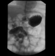 radiologycases.com Lakhoo