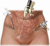 drgdiaz.com Laparoscopia