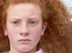 maxartis.it Lentiggini