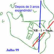 cleber.com.br Lfelipe