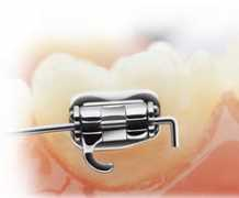 sarahburnsortho.co.uk Ligate