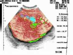 Liver
