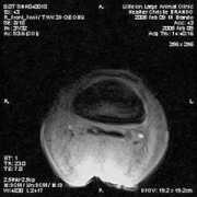 wholepicture.org Lmri