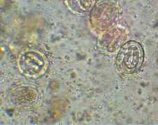 Lumbricoides