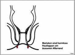 kolo-proktologie.de Mariske
