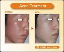 azabu-skinclinic.com Matubara