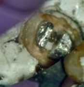 dentalindia.com Mbac