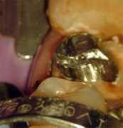 dentalindia.com Mbac