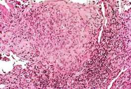 pathhsw5m54.ucsf.edu Mgran