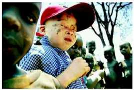 healthofchildren.com Morara