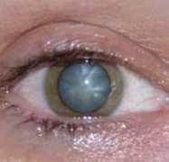 morelaoptika.si Mreno