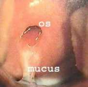 Mucus