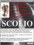 scoliosis2005.narod.ru Mukush