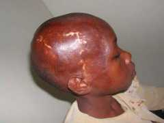 childrenoffire.org Mwikali