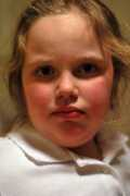 Mysis