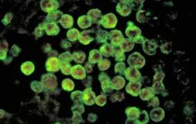 timeslive.co.za Naegleria