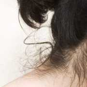 Nape