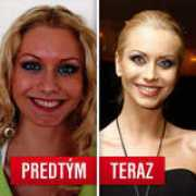 topky.sk Natiera