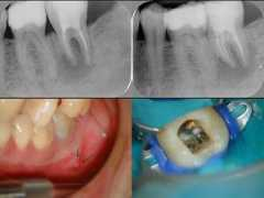 dentalindia.com Niceh