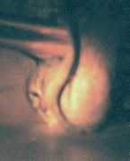 Ninga